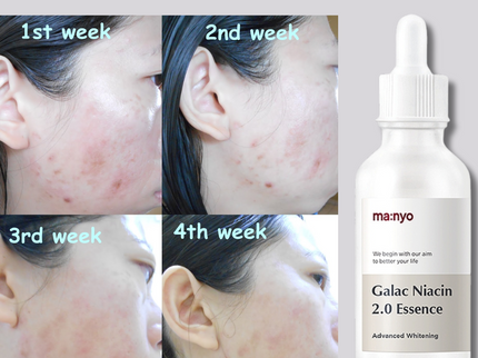 MA:NYO Galactomy Niacin Essence 50ml