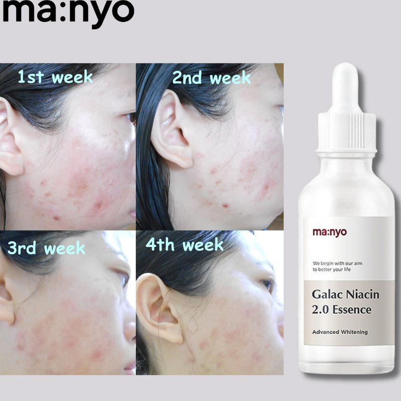 MA:NYO Galactomy Niacin Essence 50ml