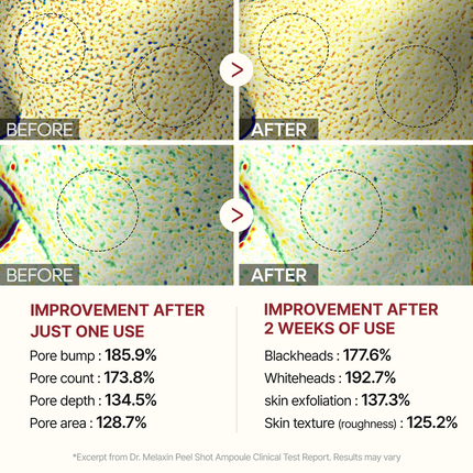 Dr. Melaxin Peel Shot Exfoliant White Rice Ampoule (80ml)