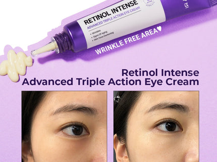 SOME BY MI Retinol Intense Trial Kit (2 Components)