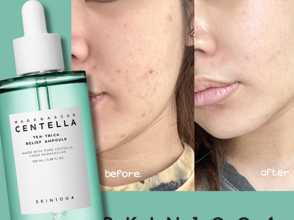 SKIN1004 MADAGASCAR CENTELLA TEA-TRICA RELIEF AMPOULE 100ml