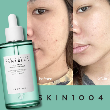 SKIN1004 MADAGASCAR CENTELLA TEA-TRICA RELIEF AMPOULE 100ml