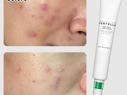 SKIN1004 Madagascar Centella Tea-Trica Spot Cream 20ml