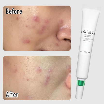 SKIN1004 Madagascar Centella Tea-Trica Spot Cream 20ml