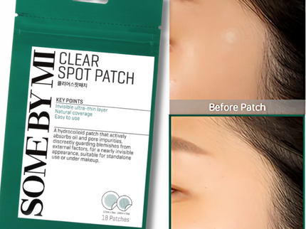 SOME BY MI 30 Days Miracle Clear Spot Patch