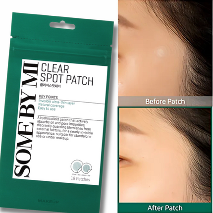 SOME BY MI 30 Days Miracle Clear Spot Patch