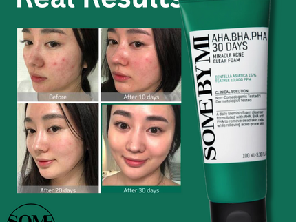 SOME BY MI AHA-BHA-PHA 30 Days Miracle Acne Clear Foam Cleanser 100ml