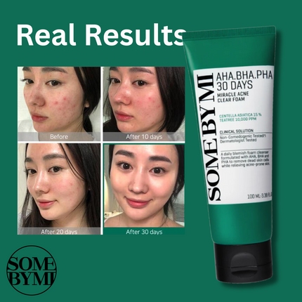 SOME BY MI AHA-BHA-PHA 30 Days Miracle Acne Clear Foam Cleanser 100ml