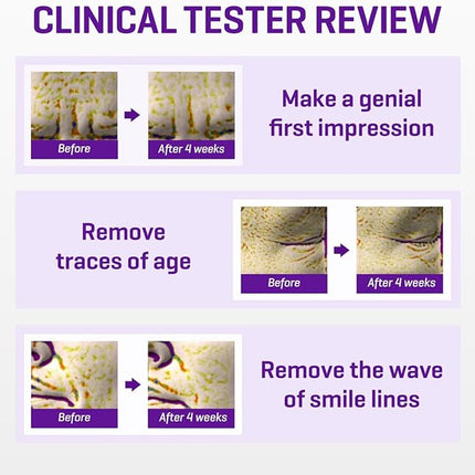 SOME BY MI Retinol Intense Eye Cream benefits Korean skincare Dubai