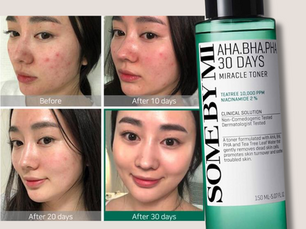 Some By Mi AHA-BHA-PHA 30 Days Miracle Face Toner 150Ml