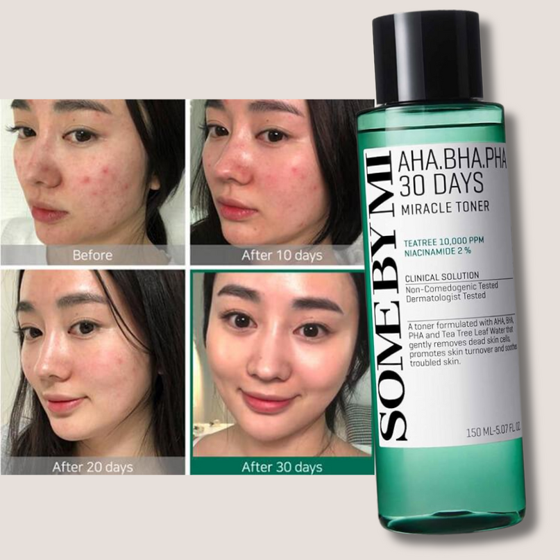 Some By Mi AHA-BHA-PHA 30 Days Miracle Face Toner 150Ml