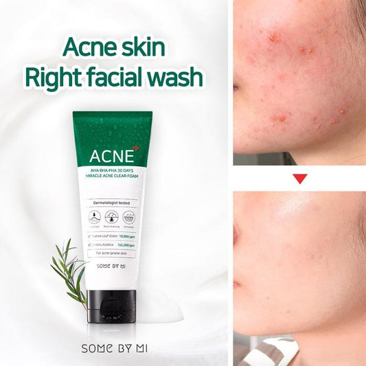 SOME BY MI AHA-BHA-PHA 30 Days Miracle Acne Clear Foam Cleanser 100ml