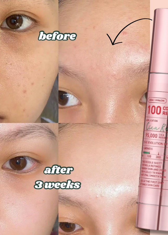 VT COSMETICS Collagen Reedle Shot 100