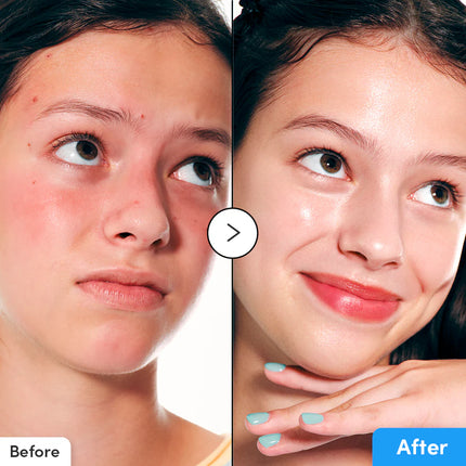 Eqqualberry Hyaltoin Flooding Serum blue bottle Korean skincare Dubai